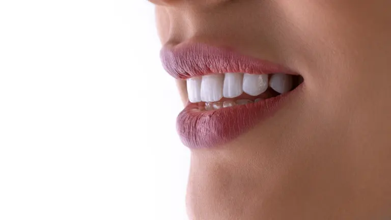 Nahaufnahme des unteren Gesichtsteils einer Frau mit perfekt weißen Zähnen und natürlichem Lippenstift.
